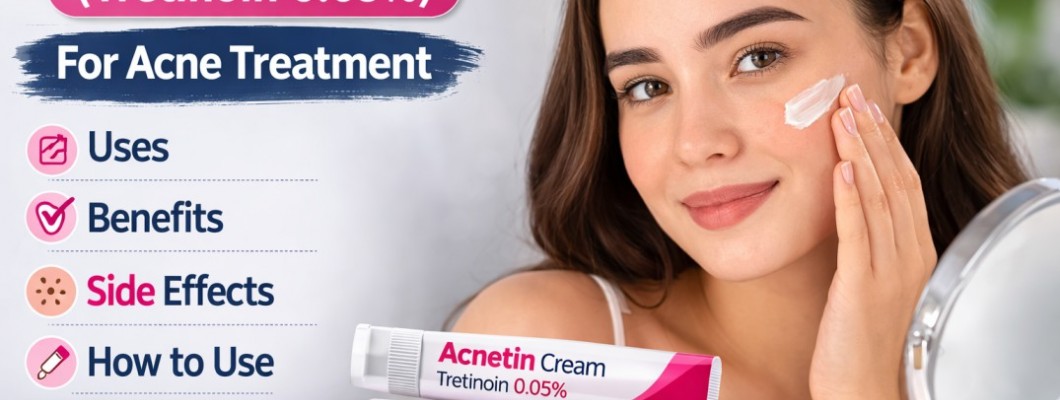 Acnetin Cream (Tretinoin 0.05%) for Acne: Uses, Benefits, Side Effects & How to Use